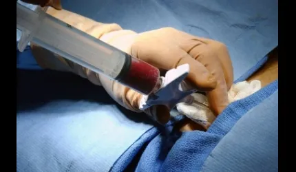 Kemik İliği Nakli, Organ Nakli ile Karıştırılıyor